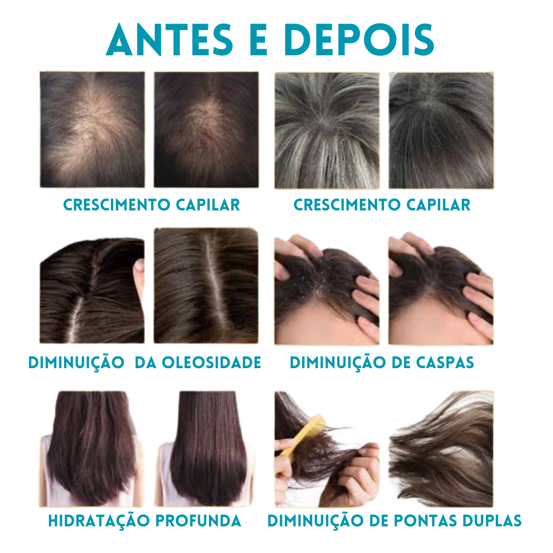 LedTerapy - Escova de Fototerapia